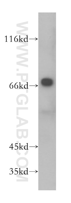 Western Blot (WB) analysis of Jurkat cells using GMPS Polyclonal antibody (16376-1-AP)