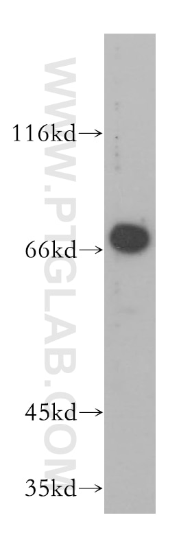 Western Blot (WB) analysis of HeLa cells using GMPS Polyclonal antibody (16376-1-AP)