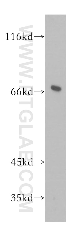 Western Blot (WB) analysis of mouse brain tissue using GMPS Polyclonal antibody (16376-1-AP)