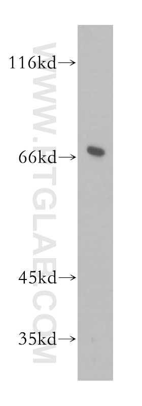 WB analysis of mouse brain using 16376-1-AP