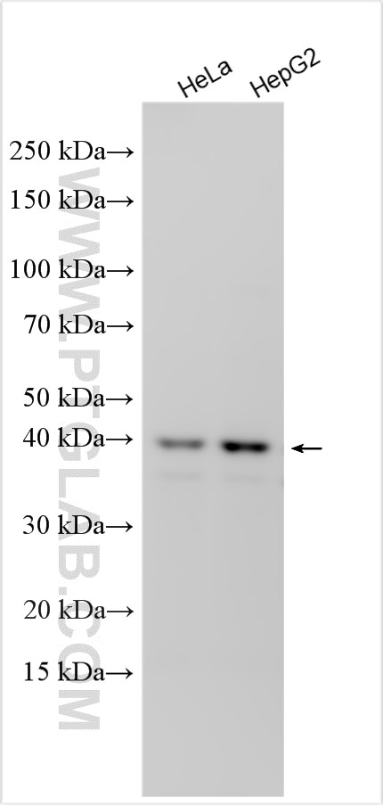 GNA12
