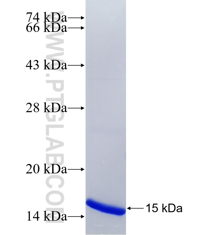 GNA12 fusion protein Ag35461 SDS-PAGE GNA12 fusion protein Ag35461 SDS-PAGE