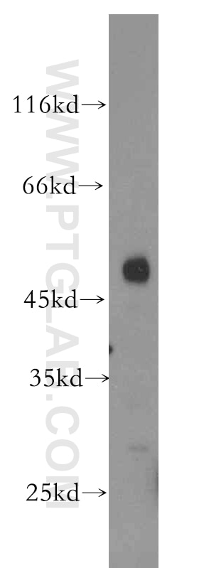 Western Blot (WB) analysis of human testis tissue using G Alpha 13 Polyclonal antibody (15142-1-AP)