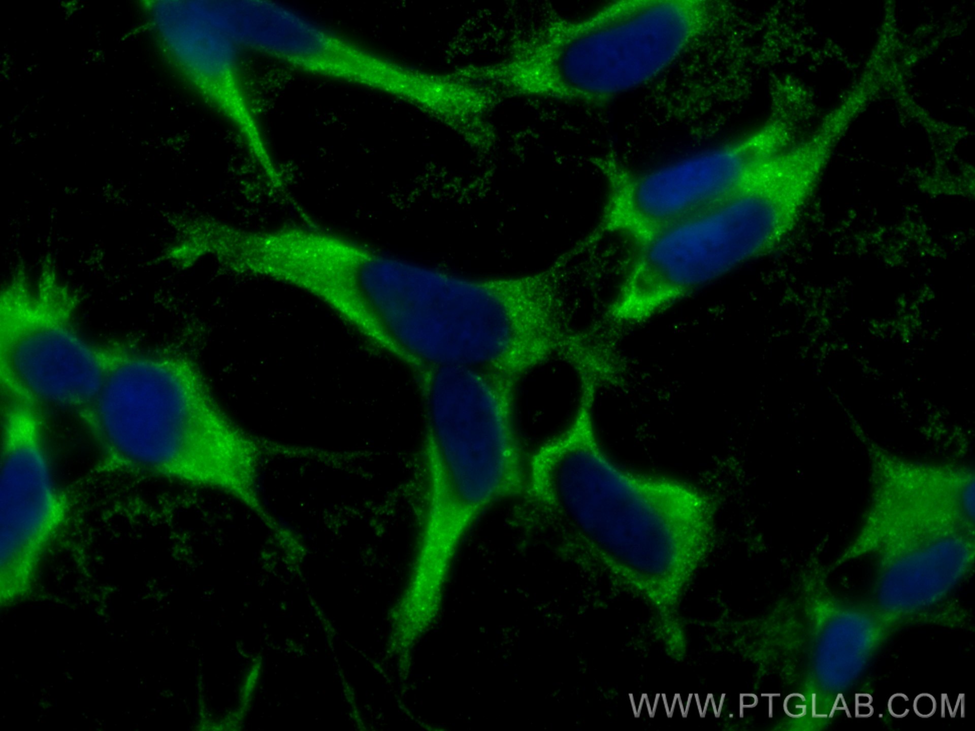 Immunofluorescence (IF) / fluorescent staining of SH-SY5Y cells using GNA13 Monoclonal antibody (67188-1-Ig)