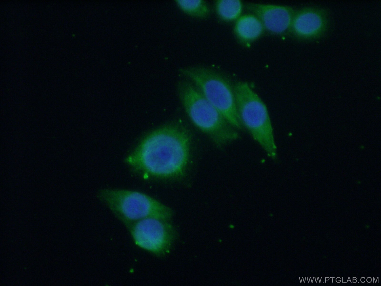 Immunofluorescence (IF) / fluorescent staining of HeLa cells using GNA14 Polyclonal antibody (13350-1-AP)