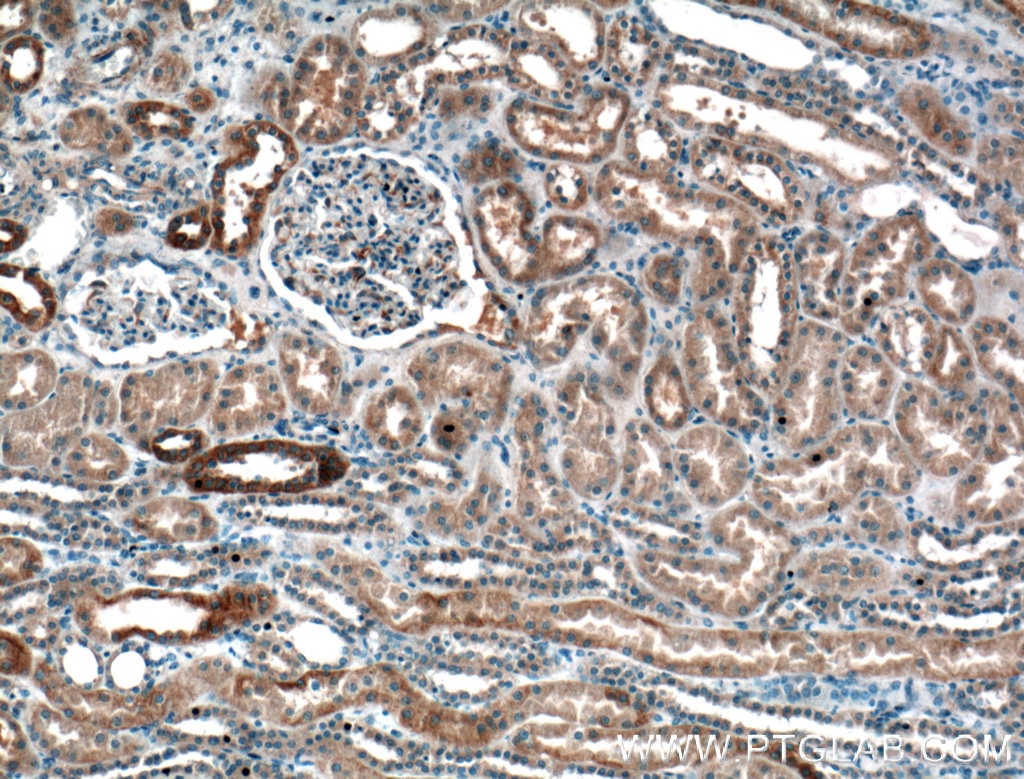 Immunohistochemistry (IHC) staining of human kidney tissue using GNA14 Polyclonal antibody (13350-1-AP)