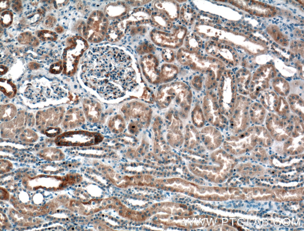 IHC staining of human kidney using 13350-1-AP