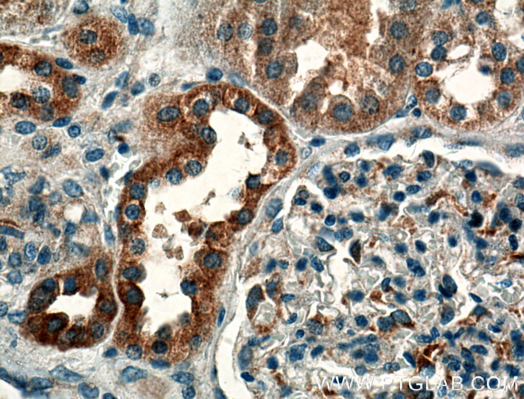 Immunohistochemistry (IHC) staining of human kidney tissue using GNA14 Polyclonal antibody (13350-1-AP)