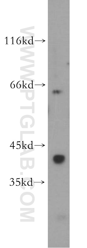 Western Blot (WB) analysis of mouse lung tissue using GNA14 Polyclonal antibody (13350-1-AP)