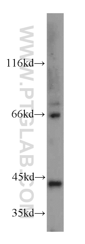 Western Blot (WB) analysis of mouse lung tissue using GNA14 Polyclonal antibody (13350-1-AP)