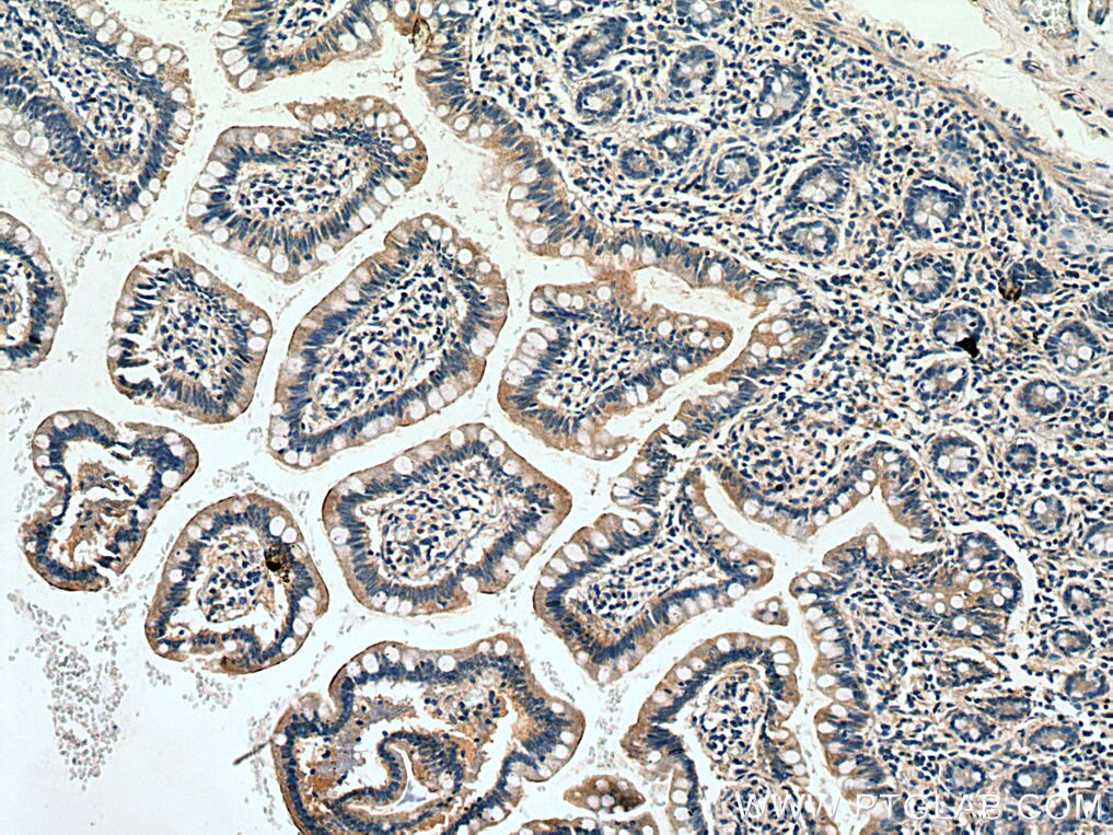 Immunohistochemistry (IHC) staining of human small intestine tissue using GNA15 Polyclonal antibody (12078-1-AP)