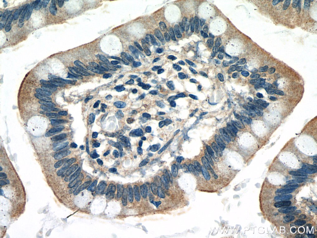 IHC staining of human small intestine using 12078-1-AP