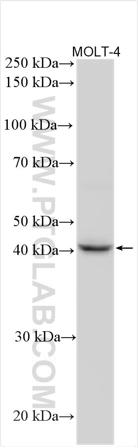 Western Blot (WB) analysis of various lysates using GNA15 Polyclonal antibody (12078-1-AP)