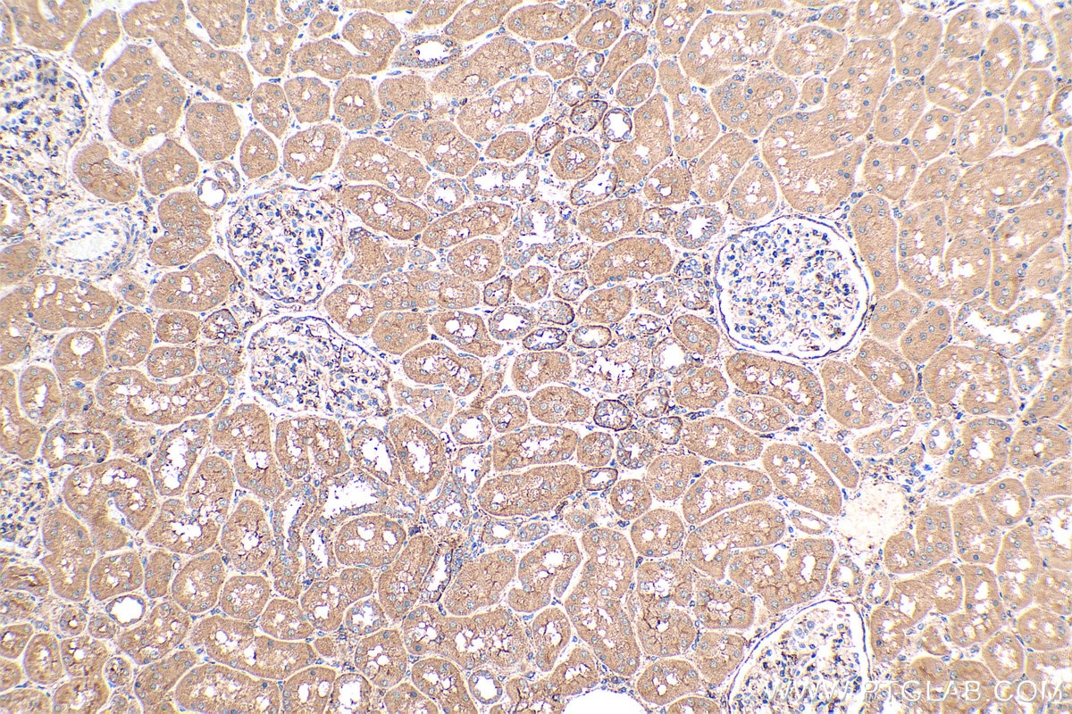 Immunohistochemistry (IHC) staining of human kidney tissue using GNAI1 Polyclonal antibody (12617-1-AP)