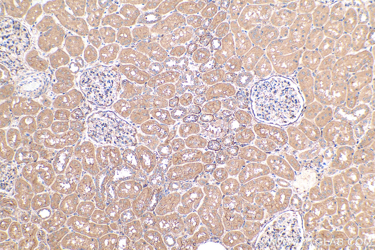 IHC staining of human kidney using 12617-1-AP