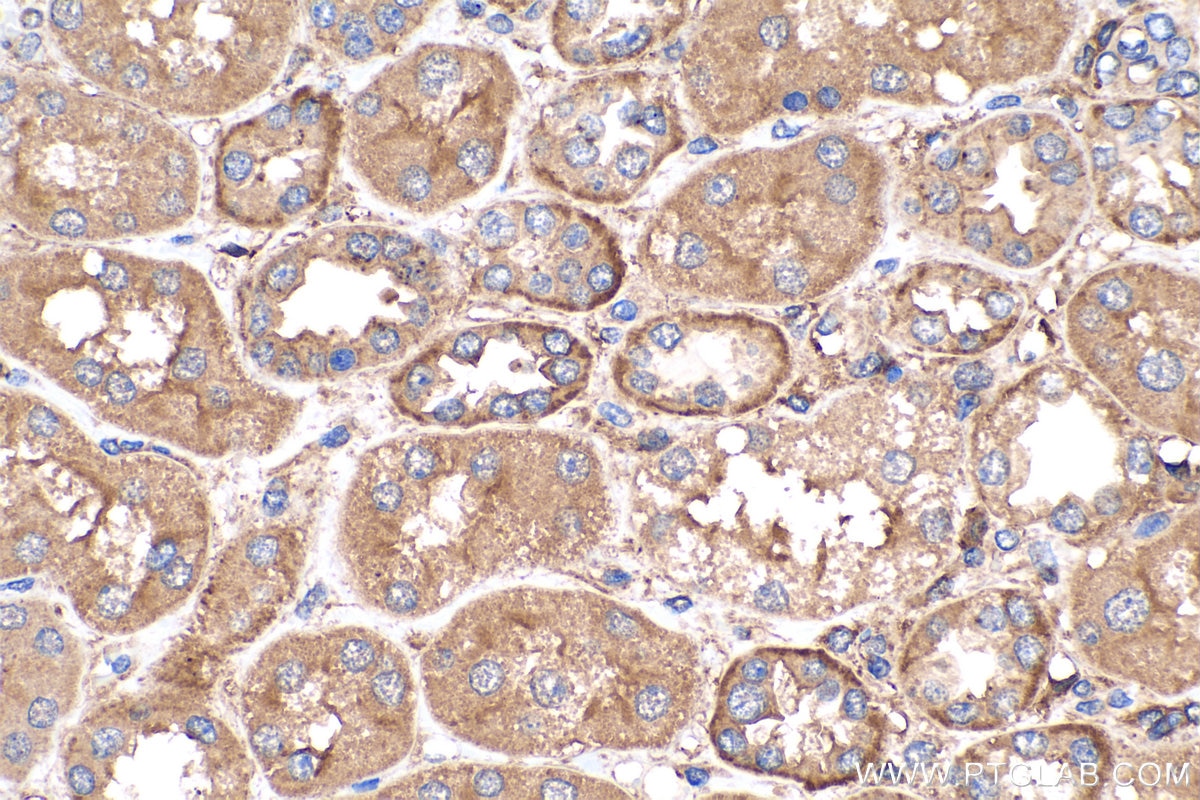 Immunohistochemistry (IHC) staining of human kidney tissue using GNAI1 Polyclonal antibody (12617-1-AP)