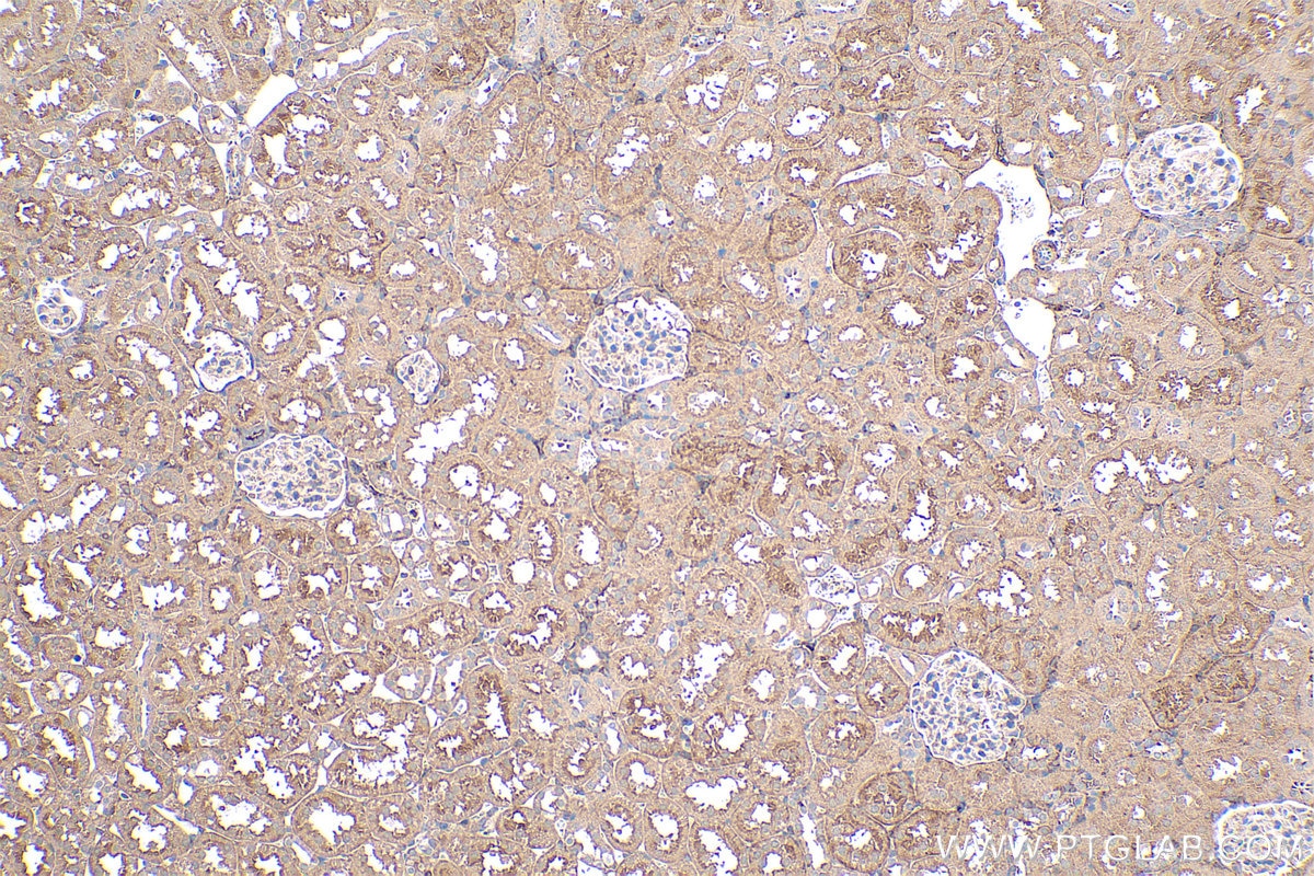 Immunohistochemistry (IHC) staining of rat kidney tissue using GNAI1 Polyclonal antibody (12617-1-AP)