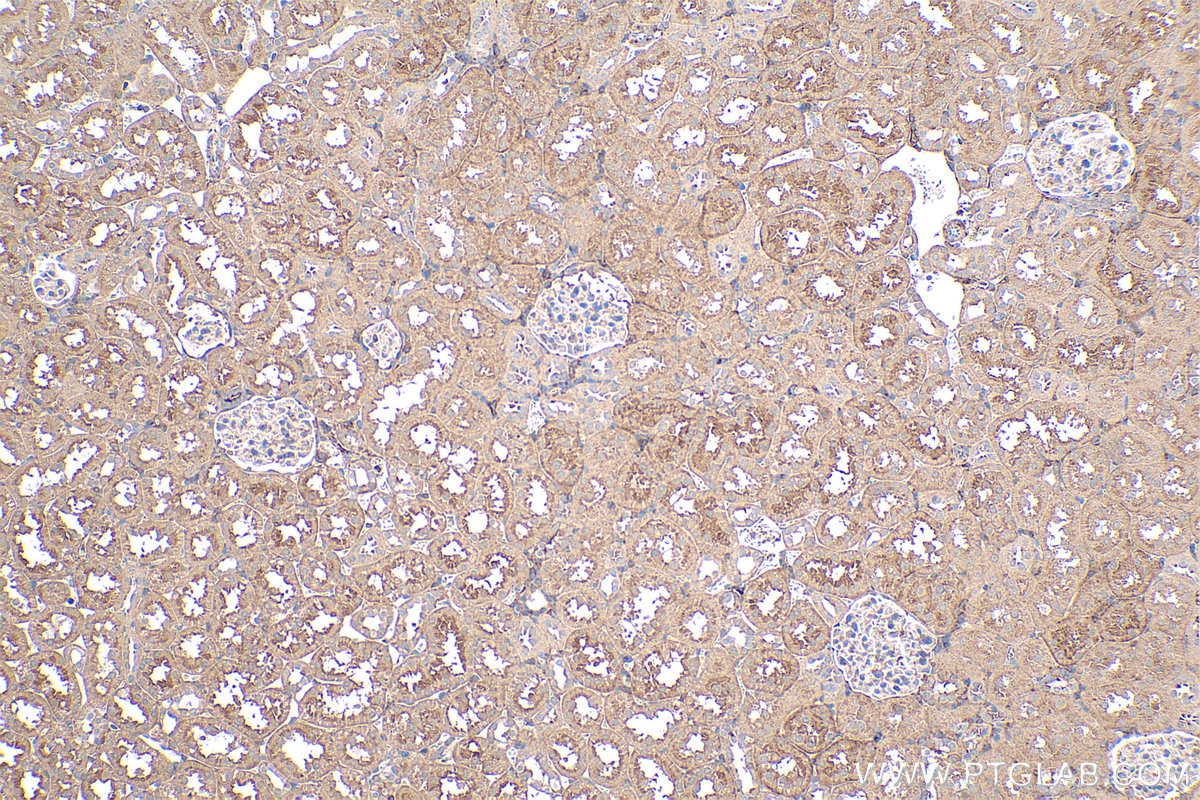 IHC staining of rat kidney using 12617-1-AP