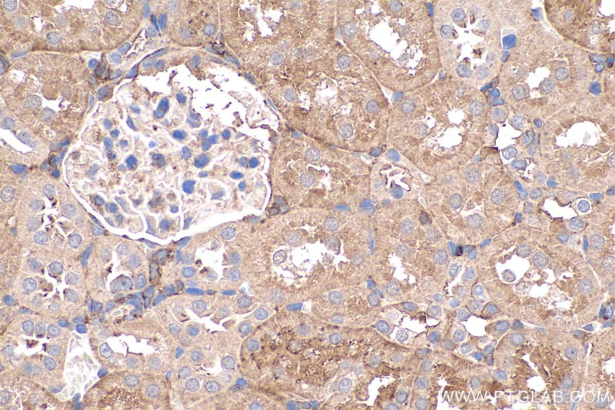 Immunohistochemistry (IHC) staining of rat kidney tissue using GNAI1 Polyclonal antibody (12617-1-AP)