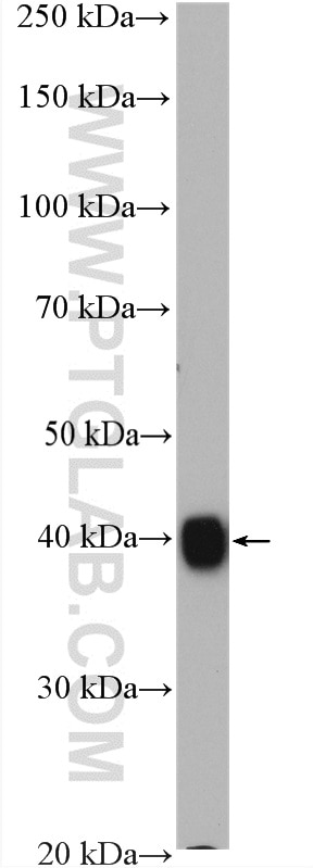 Western Blot (WB) analysis of fetal human brain tissue using GNAI1 Polyclonal antibody (12617-1-AP)