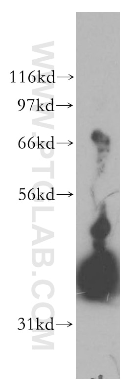 GNAI1 Polyclonal antibody