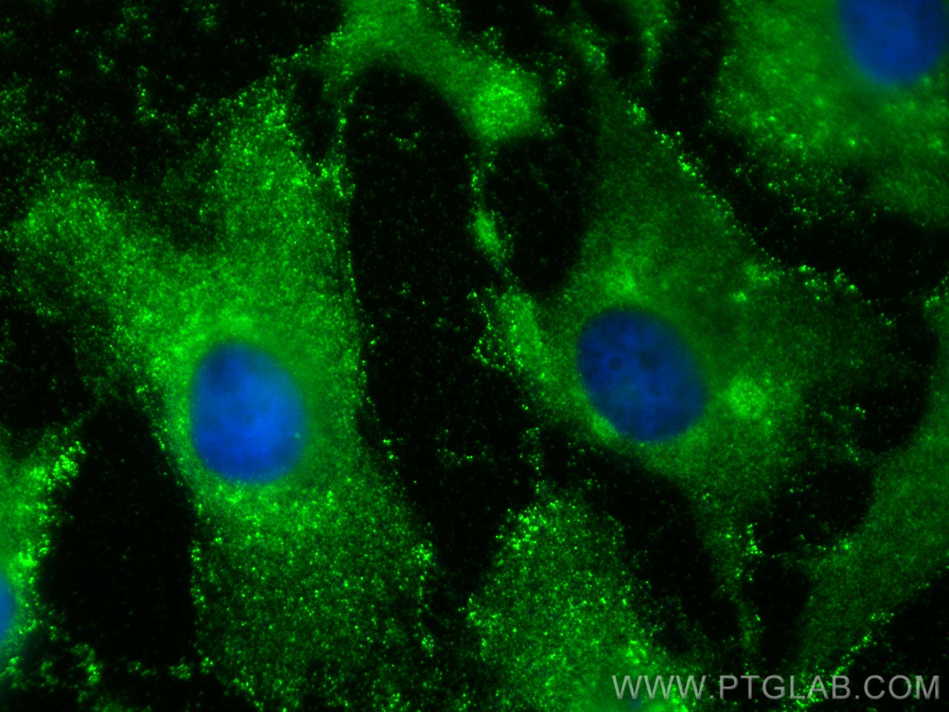 Immunofluorescence (IF) / fluorescent staining of HeLa cells using GNAI2 Polyclonal antibody (11136-1-AP)