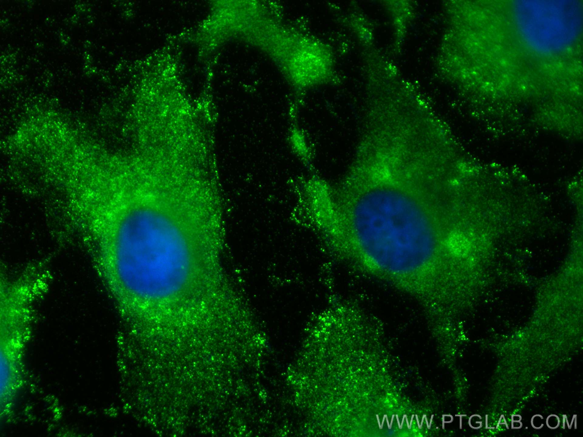 IF Staining of HeLa using 11136-1-AP