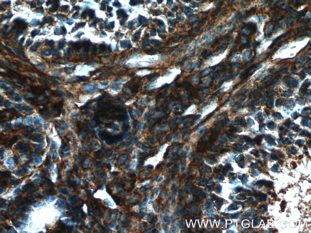 Immunohistochemistry (IHC) staining of mouse ovary tissue using GNAI2 Polyclonal antibody (11136-1-AP)