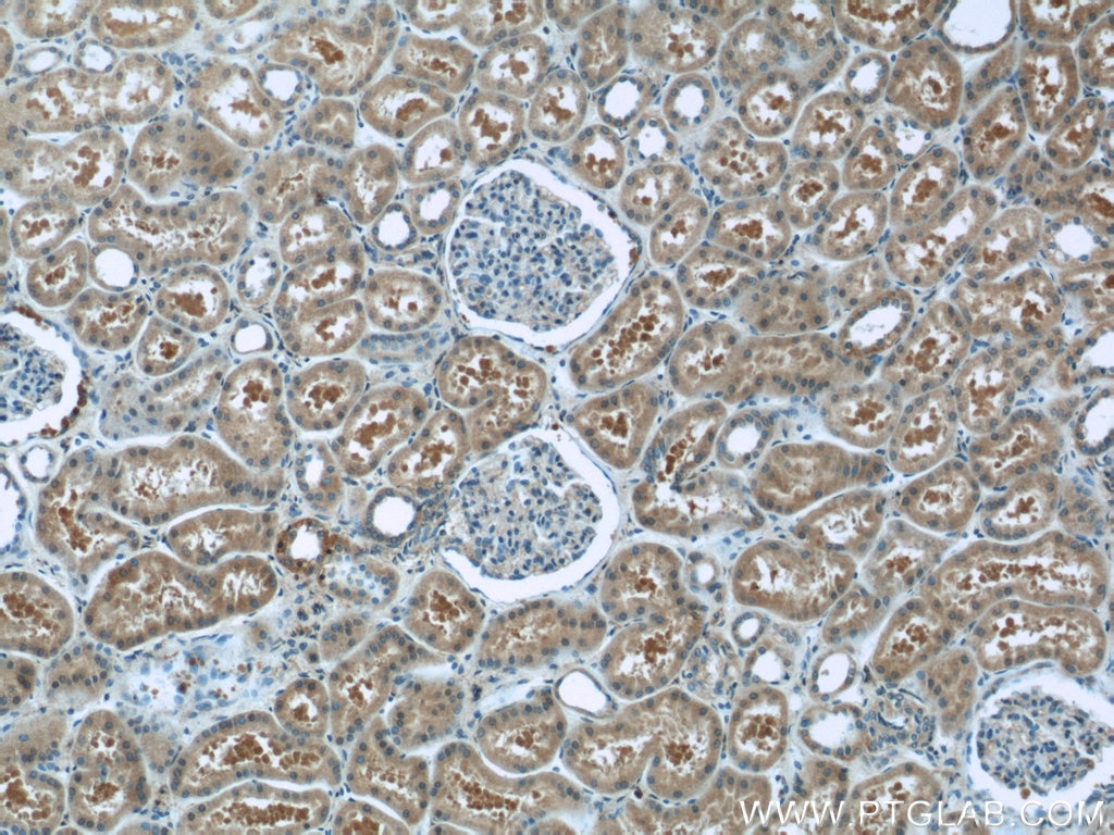 Immunohistochemistry (IHC) staining of human kidney tissue using GNAI2 Polyclonal antibody (11136-1-AP)