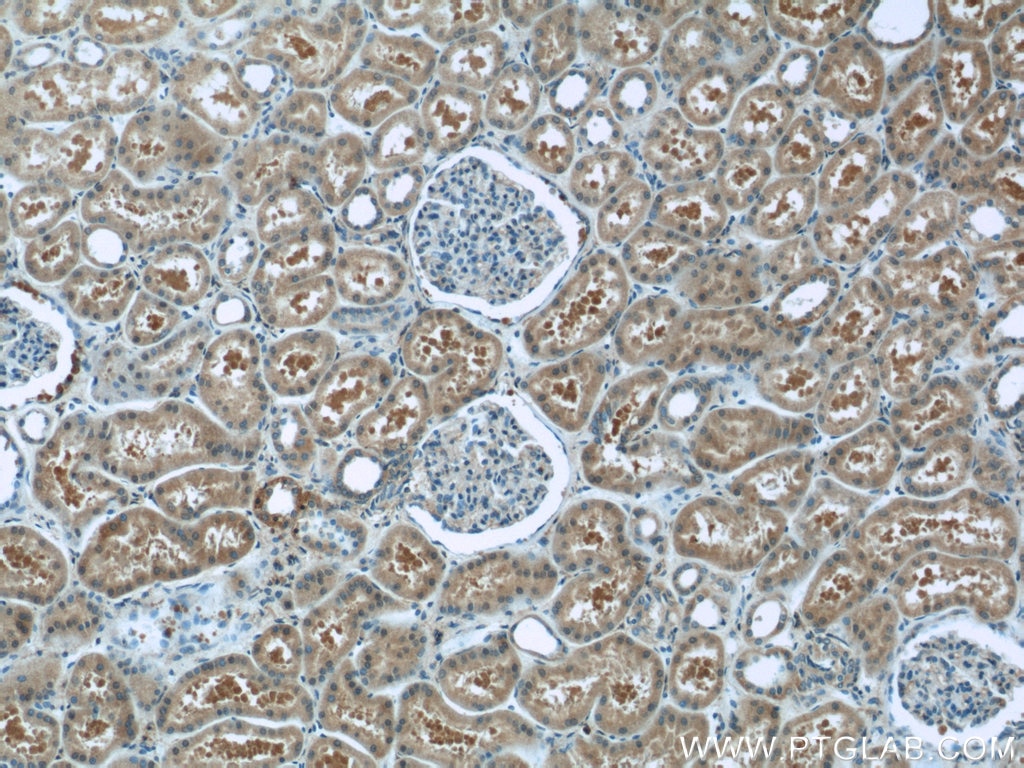 IHC staining of human kidney using 11136-1-AP