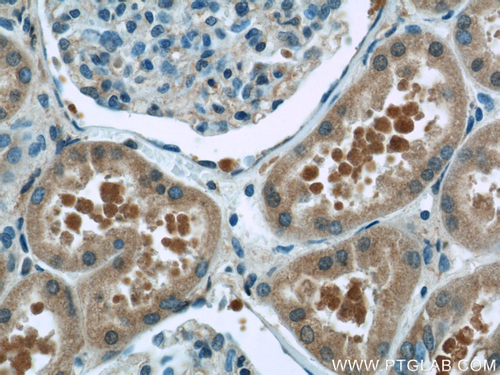 Immunohistochemistry (IHC) staining of human kidney tissue using GNAI2 Polyclonal antibody (11136-1-AP)