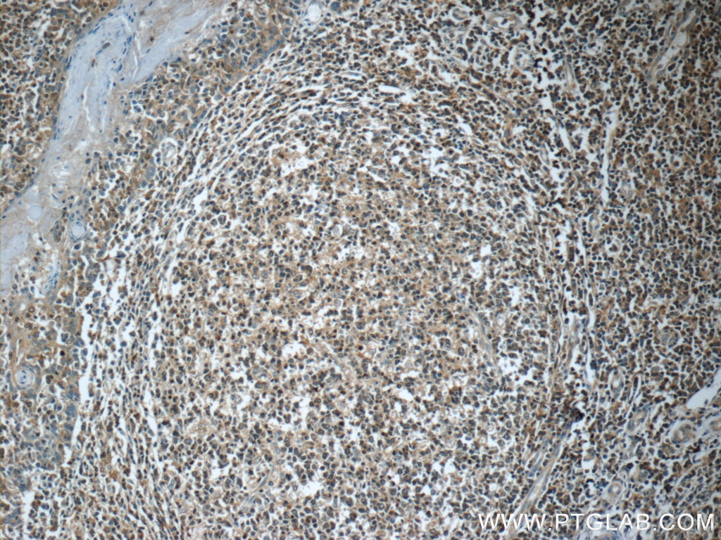 Immunohistochemistry (IHC) staining of human tonsillitis tissue using GNAI2 Polyclonal antibody (11136-1-AP)