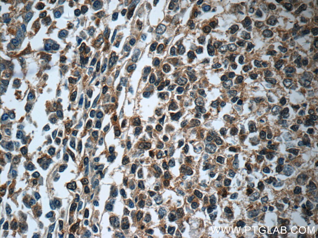 Immunohistochemistry (IHC) staining of human tonsillitis tissue using GNAI2 Polyclonal antibody (11136-1-AP)