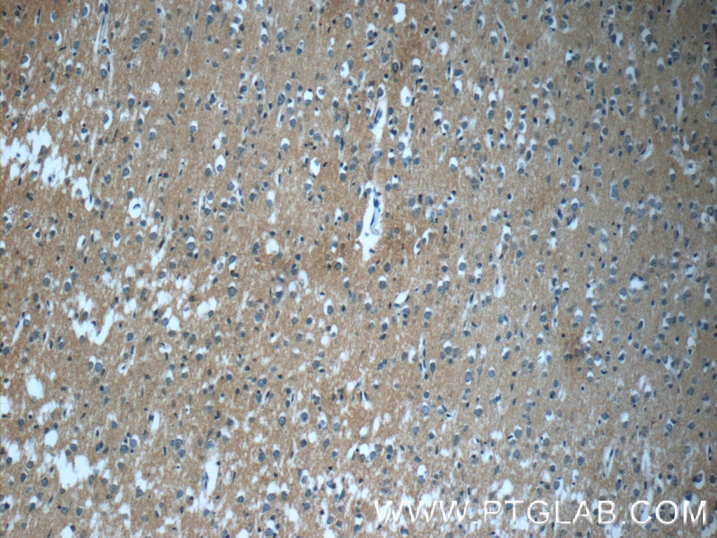 Immunohistochemistry (IHC) staining of human brain tissue using GNAI2 Polyclonal antibody (11136-1-AP)