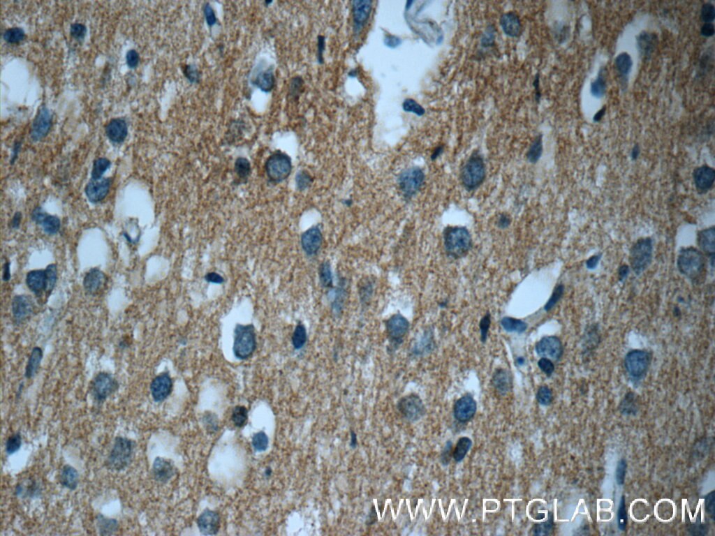 Immunohistochemistry (IHC) staining of human brain tissue using GNAI2 Polyclonal antibody (11136-1-AP)