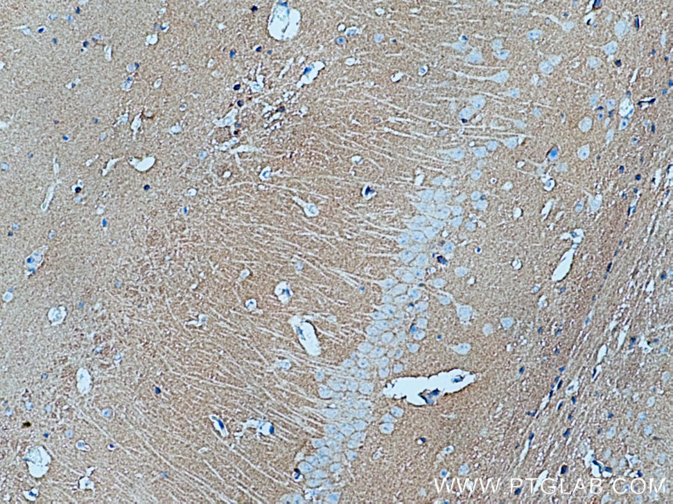 Immunohistochemistry (IHC) staining of mouse brain tissue using GNAI2 Polyclonal antibody (11136-1-AP)