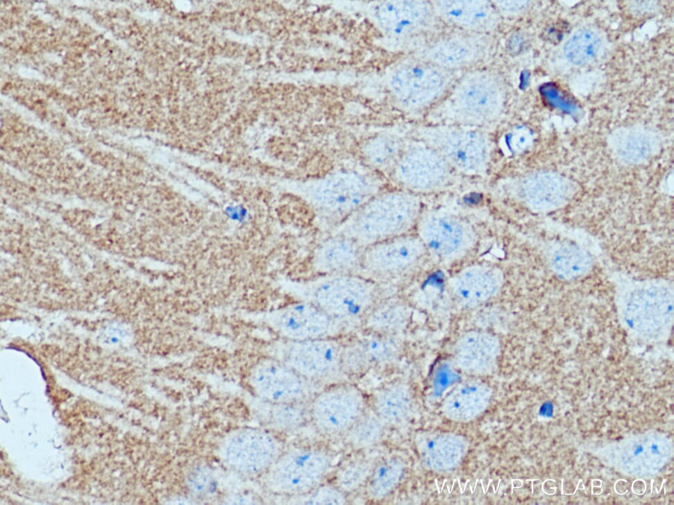 Immunohistochemistry (IHC) staining of mouse brain tissue using GNAI2 Polyclonal antibody (11136-1-AP)