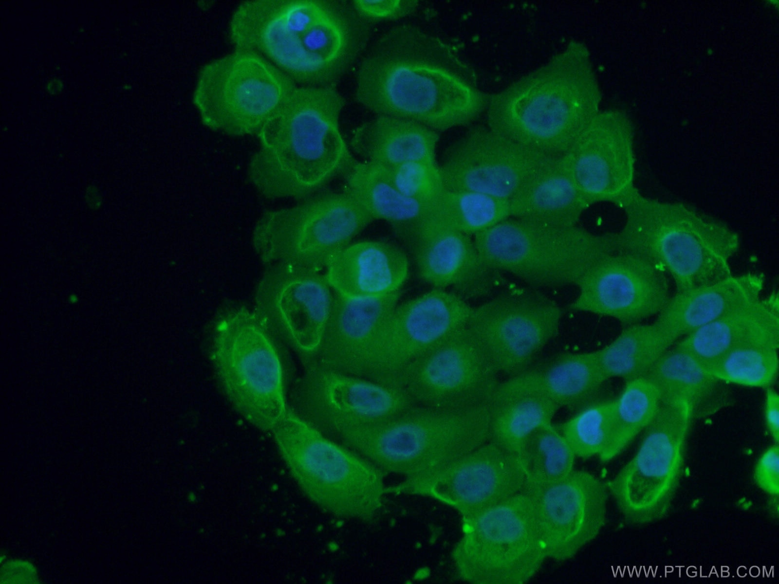 Immunofluorescence (IF) / fluorescent staining of A431 cells using GNAI2 Monoclonal antibody (67007-1-Ig)