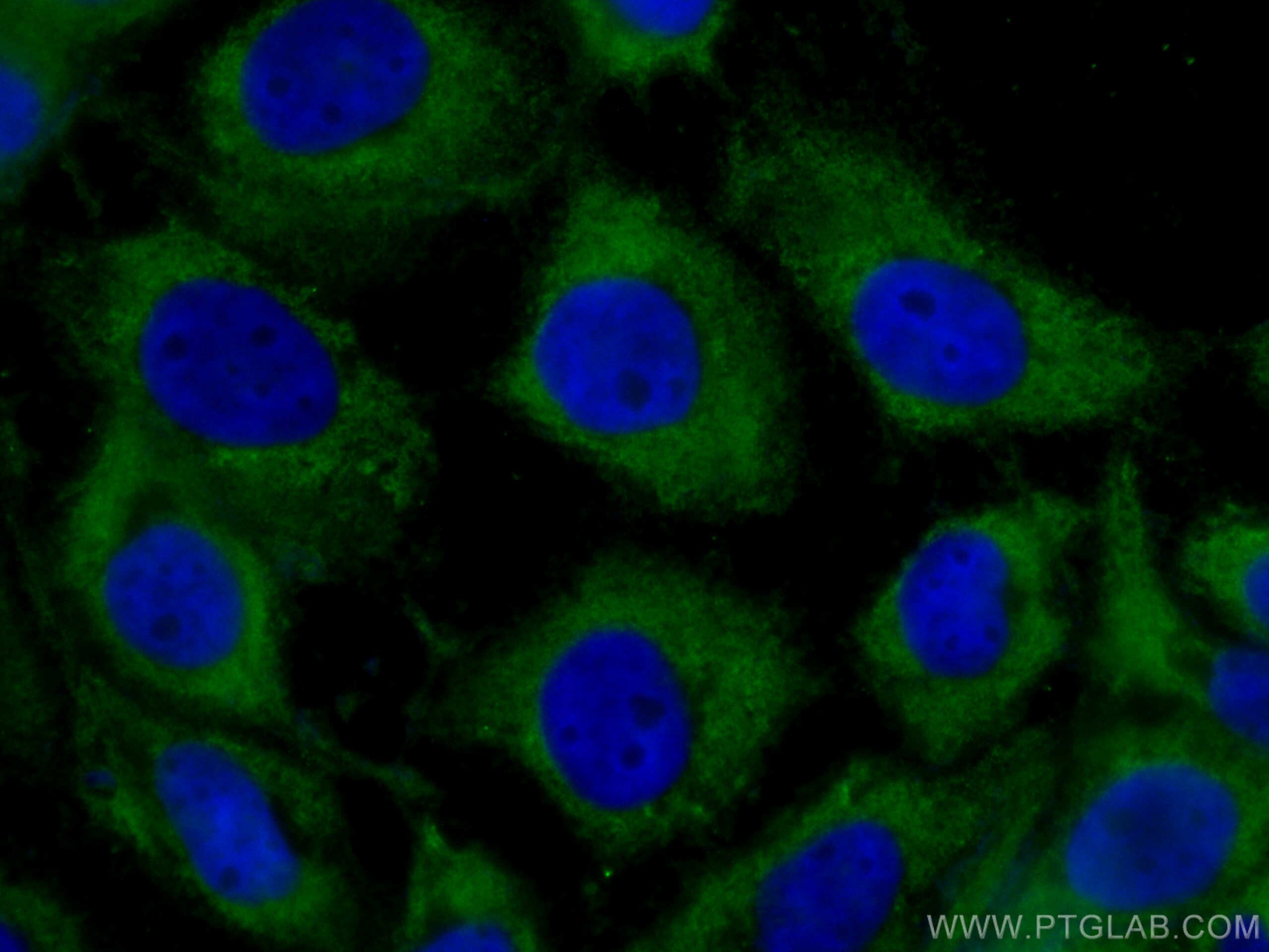 Immunofluorescence (IF) / fluorescent staining of A431 cells using CoraLite® Plus 488-conjugated GNAI2 Monoclonal ant (CL488-67007)