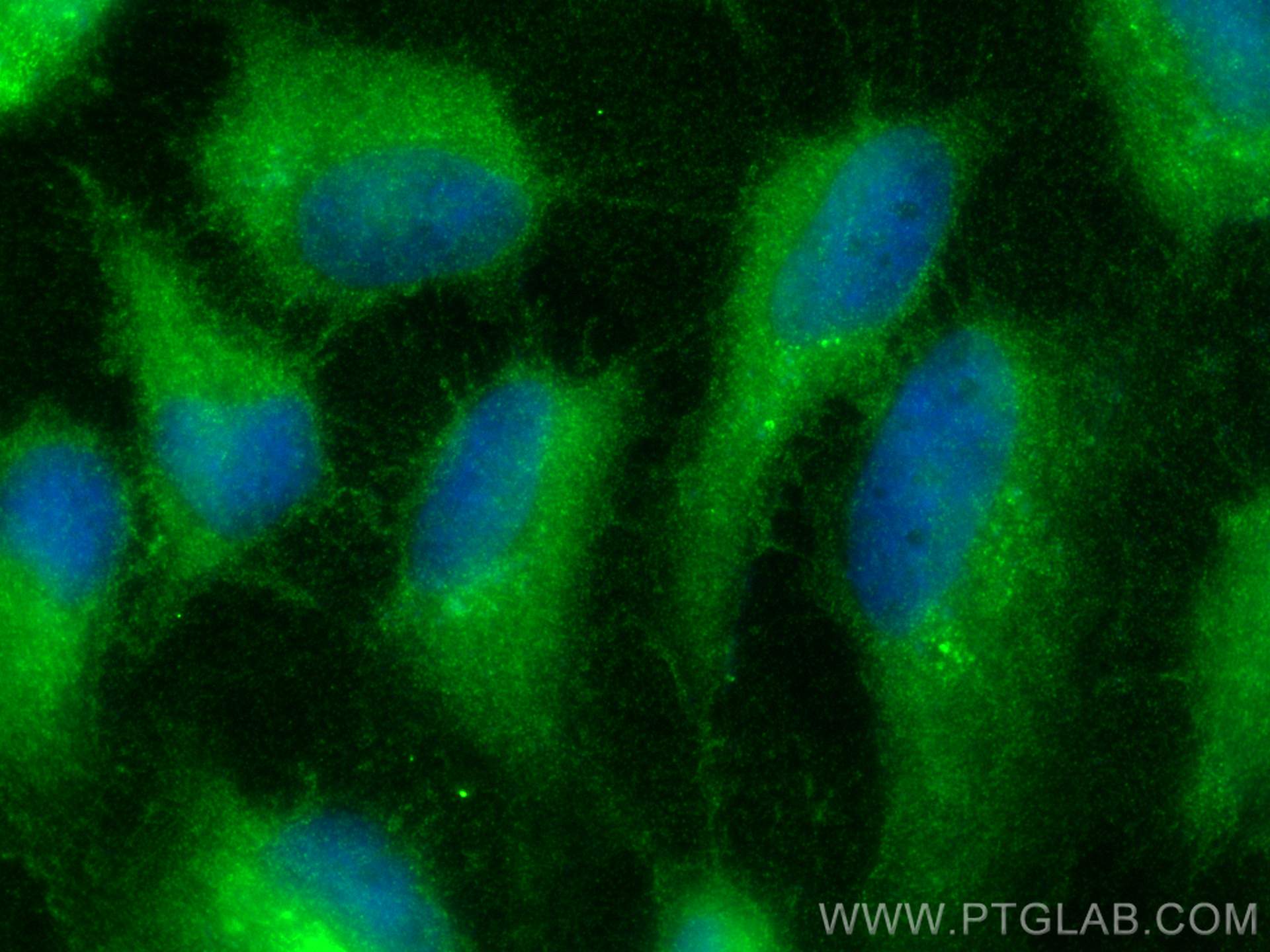 Immunofluorescence (IF) / fluorescent staining of HeLa cells using GNAI3 Polyclonal antibody (11641-1-AP)