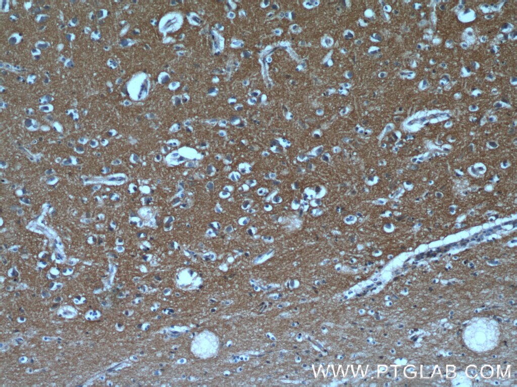 Immunohistochemistry (IHC) staining of human brain tissue using GNAI3 Polyclonal antibody (11641-1-AP)