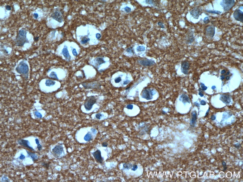 Immunohistochemistry (IHC) staining of human brain tissue using GNAI3 Polyclonal antibody (11641-1-AP)