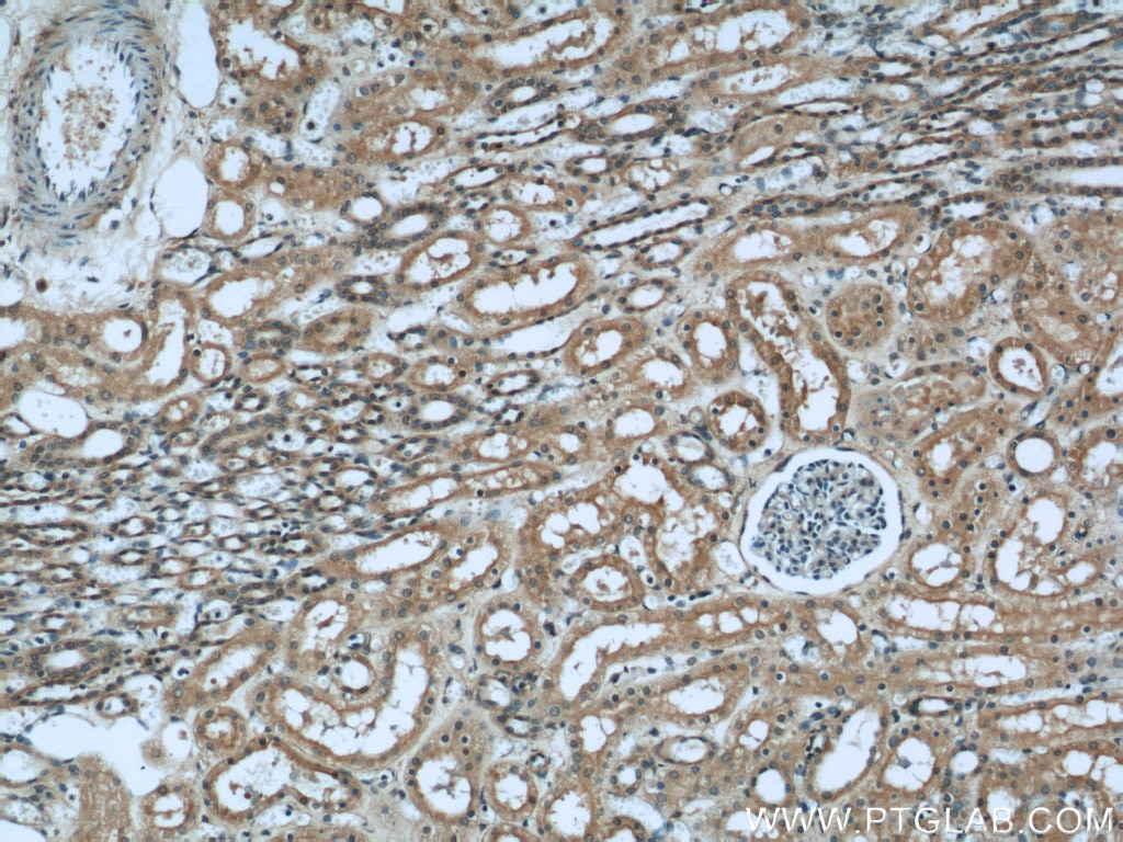 Immunohistochemistry (IHC) staining of human kidney tissue using GNAI3 Polyclonal antibody (11641-1-AP)