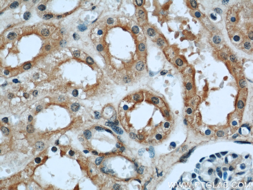 Immunohistochemistry (IHC) staining of human kidney tissue using GNAI3 Polyclonal antibody (11641-1-AP)