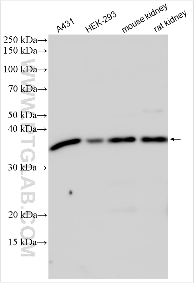 Western Blot (WB) analysis of various lysates using GNAI3 Polyclonal antibody (11641-1-AP)