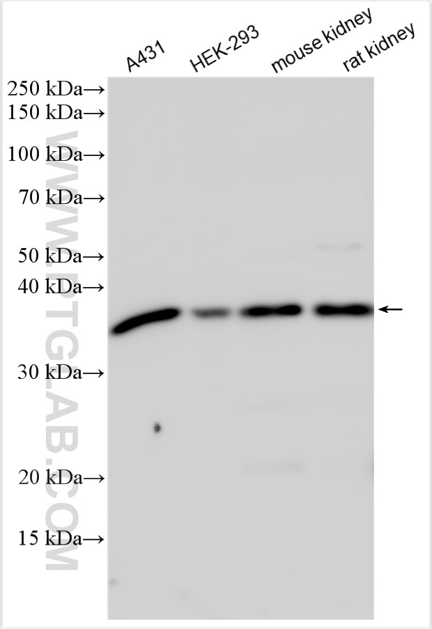 WB analysis using 11641-1-AP