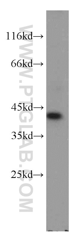 Western Blot (WB) analysis of human kidney tissue using GNAI3 Polyclonal antibody (11641-1-AP)