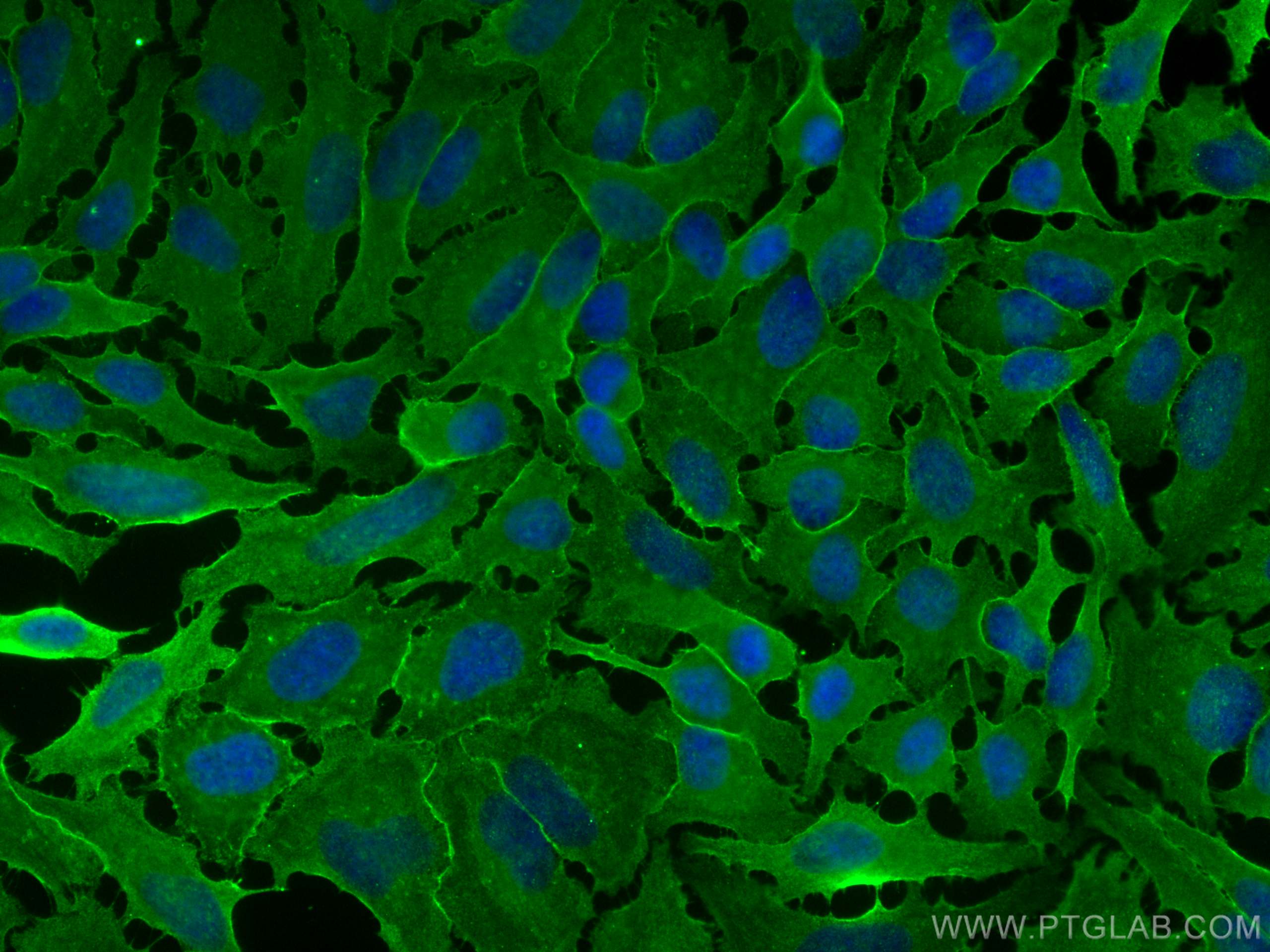 Immunofluorescence (IF) / fluorescent staining of HeLa cells using GNAI3 Monoclonal antibody (68156-1-Ig)