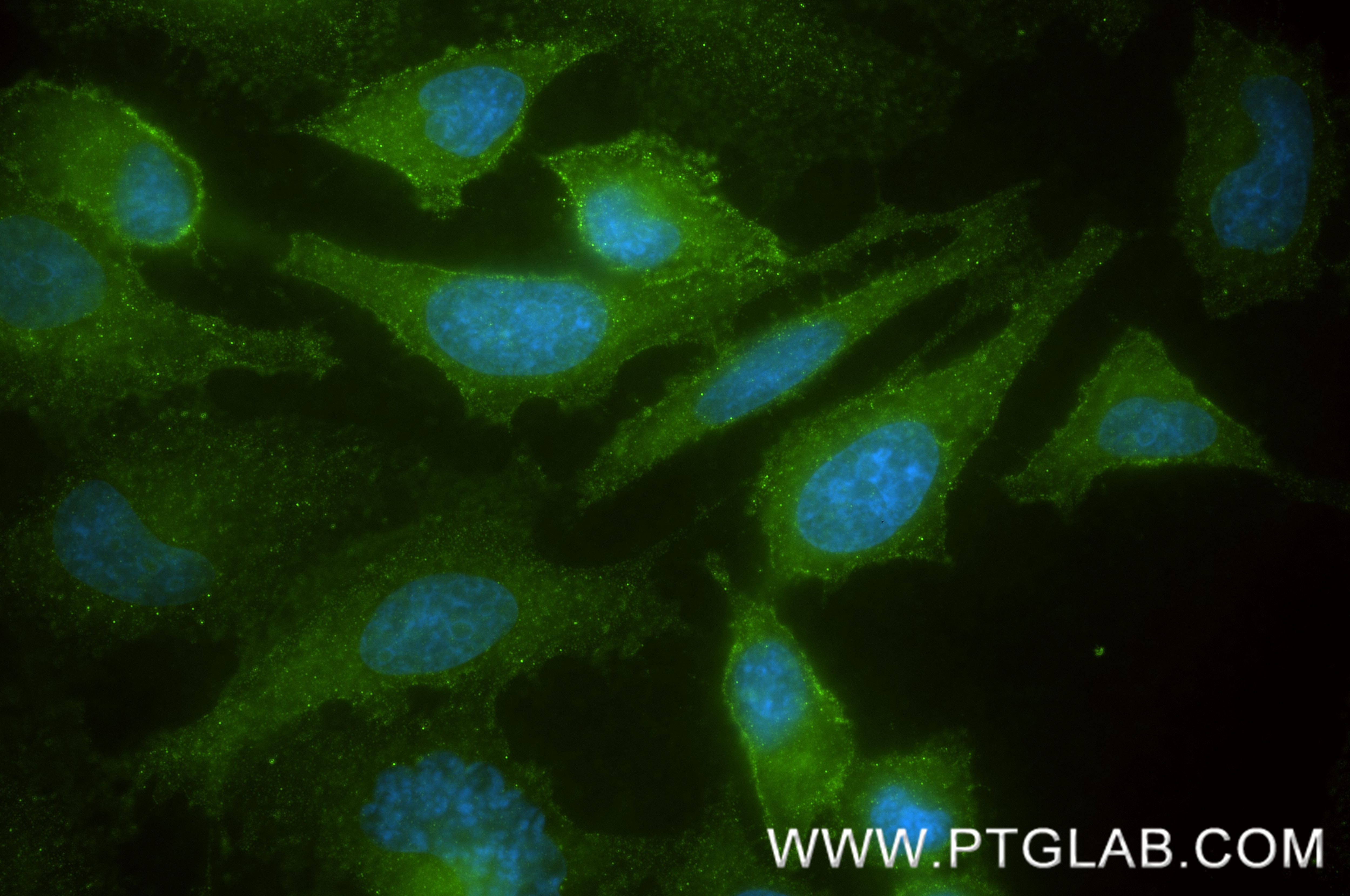 IF Staining of HeLa using 88438-1-RR (same clone as 88438-1-PBS) Immunofluorescence (IF) / fluorescent staining of HeLa cells using GNAI3 Recombinant monoclonal antibody (88438-1-RR)