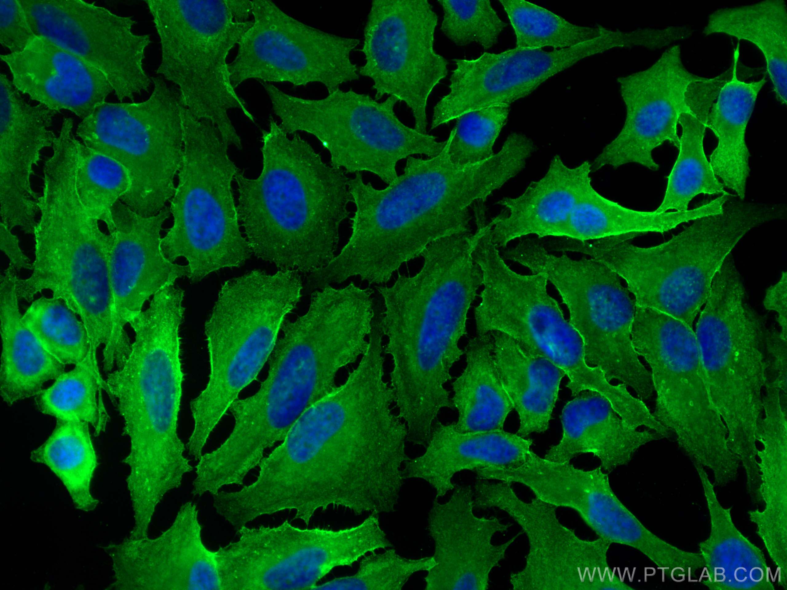 Immunofluorescence (IF) / fluorescent staining of HeLa cells using CoraLite® Plus 488-conjugated GNAI3 Monoclonal ant (CL488-68156)